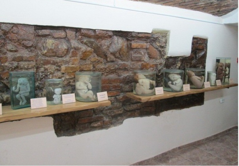 гродненская кунсткамера гродно. анатомическая экспозиция гродненская. музей гродно кунсткамера. музей гродно кунсткамера. музей тератологии в гродно.